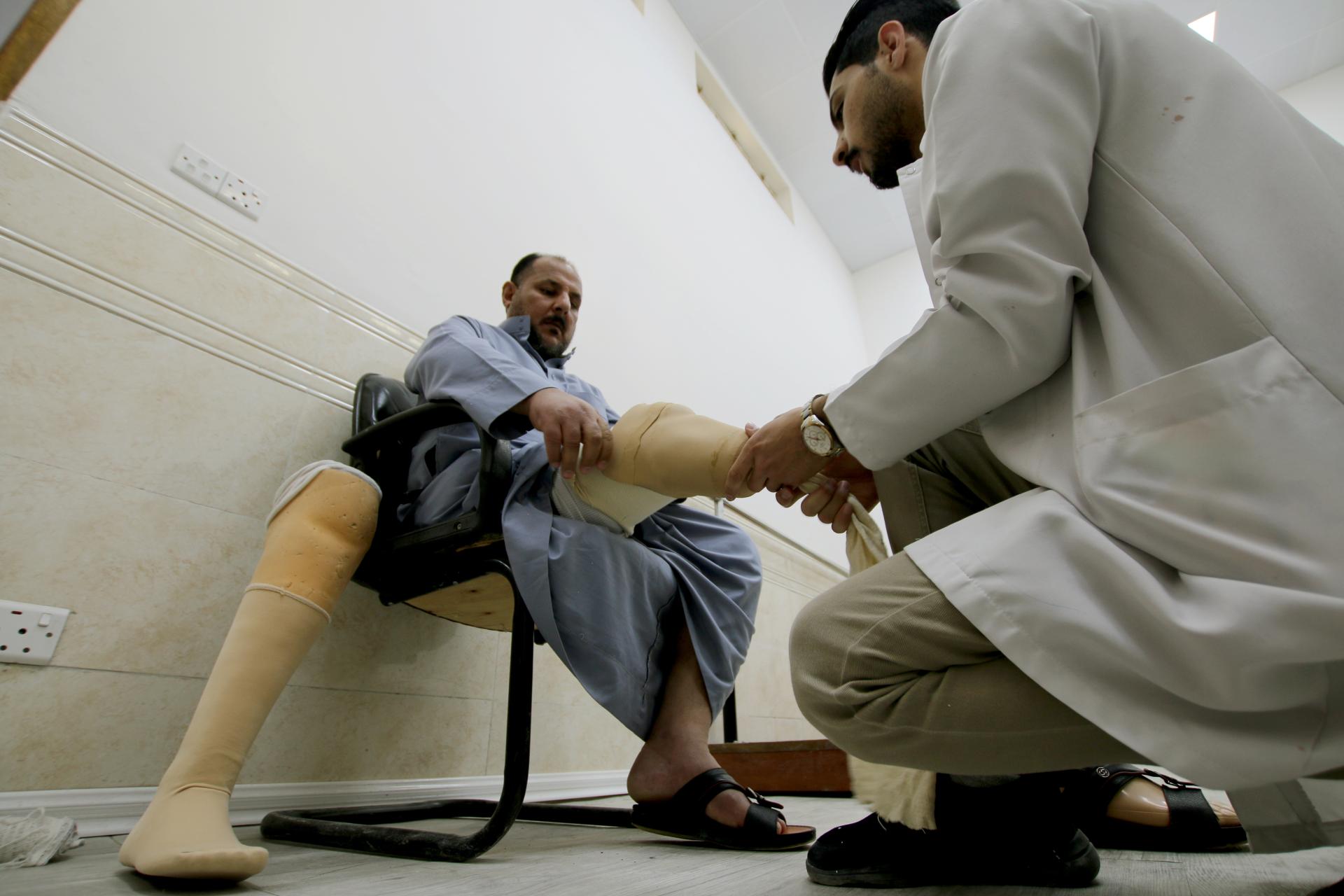 A man getting a prosthetic leg put into place