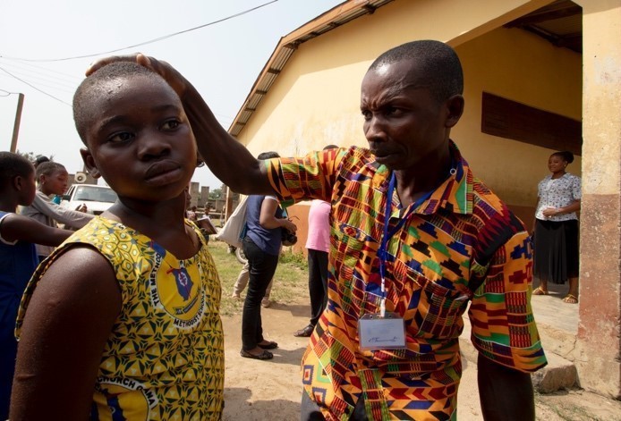 イチゴ腫のスクリーニングと検査を受ける、ガーナ西アキム郡の学生たち