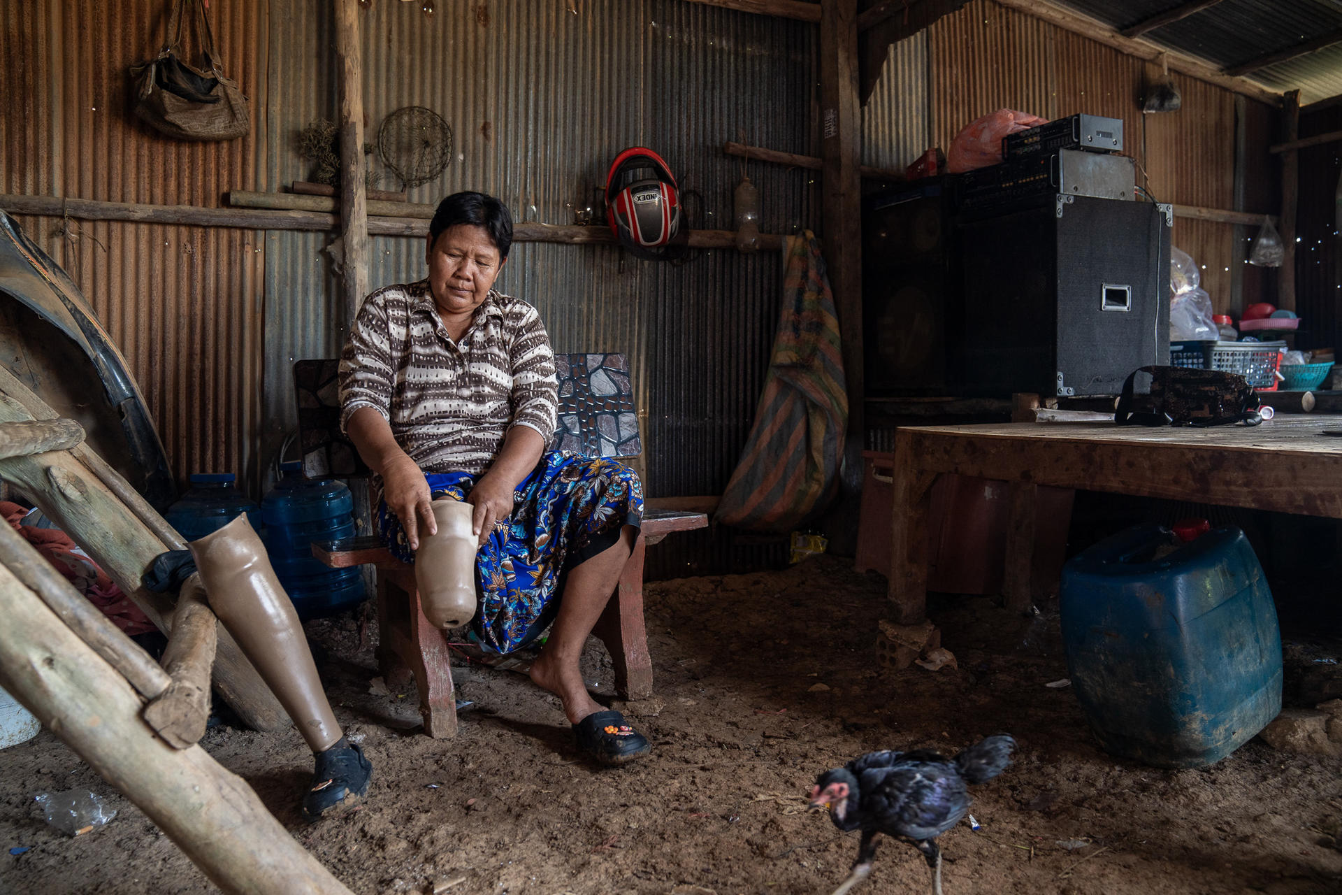 Smiling woman in a rustic room with a chicken and discarded prosthetic limbs.