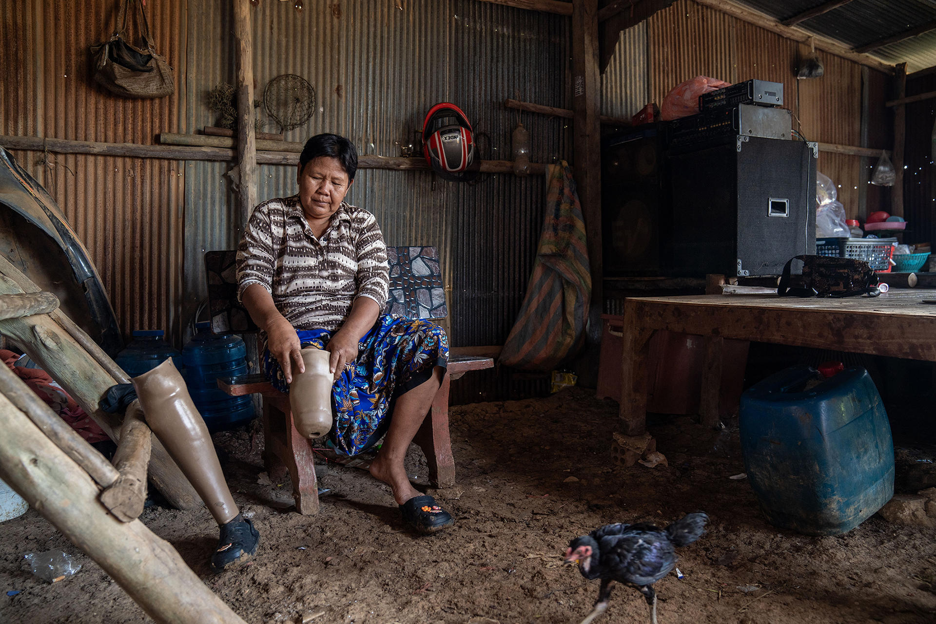 Woman sitting in a shed, with a prosthetic leg.