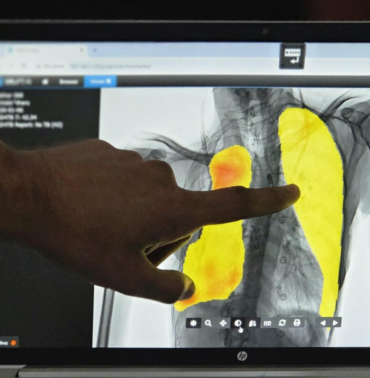 Photograph on laptop screen shows grayscale image with two yellow regions; a hand points.