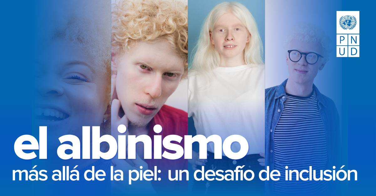 Banner about albinism with four diverse people on a blue gradient, Spanish text about inclusion.