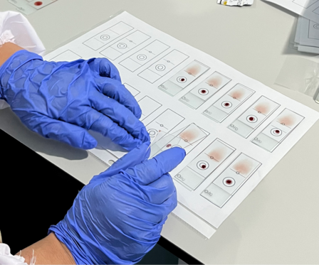 The Process of Blood Slide Standardization
